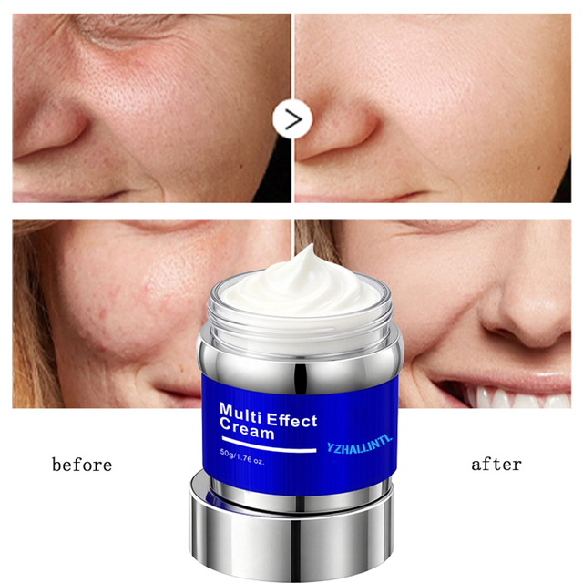 how long to see results ghk cu Amazon.com: Skin Perfection Copper Peptide Serum GHK-CU 1% for Face & Hair  Copper Peptides for Skin, Hair, & Scalp