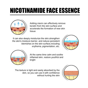 Suero Facial con Niacinamida EELHOE, Desvanece Marcas de Acné, Hidrata y Humecta, Reduce los Poros, Blanquea y Embellece la Piel, 50 ml - Product Image 2