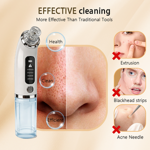 Limpiador Facial Eléctrico Portátil USB <span class=keywords><strong>AOSO</strong></span> XQP-001 con Pantalla LCD, 5 Cabezales de Succión, 1 Año de Garantía, Eliminador de Puntos Negros con Vacío Profundo - Product Image 2