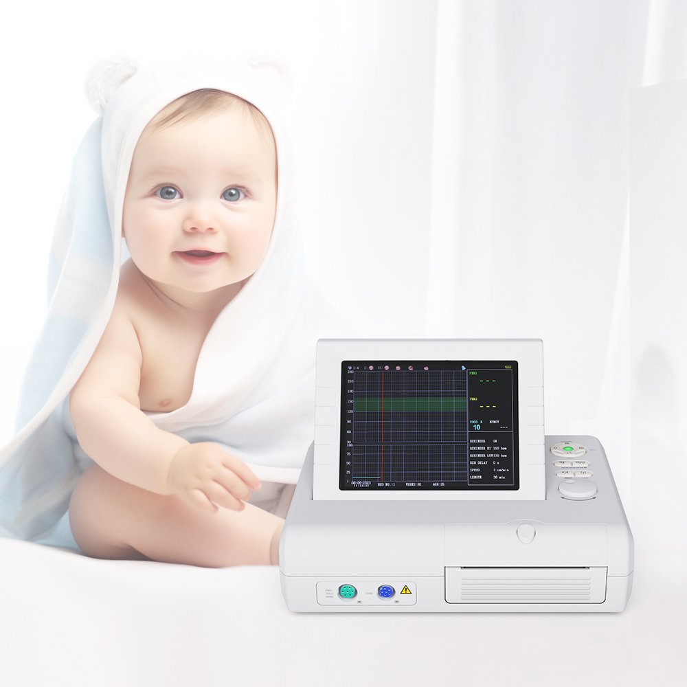 Услуги обеспечения торговли, CMS800G, портативный фетальный монитор ctg, монитор матери