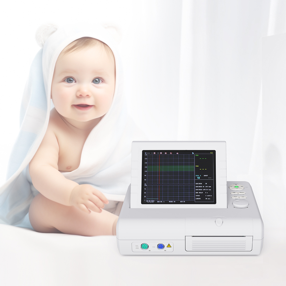 Serviço de garantia de comércio fornecido cms800g monitor fetal portátil ctg monitor maternal