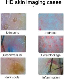 Analyseur de peau numérique professionnel de 15 pouces, caméra pour cuir chevelu, appareil de test pour follicules pileux, huile et humidité - Product Image 4