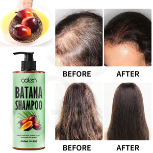 Luxfume 17oz Big Private Label Batana Champú Fortalece el cabello Elimina la <span class=keywords><strong>caspa</strong></span> Mejora la textura del cabello Uso diario Crema suavizante - Product Image 6