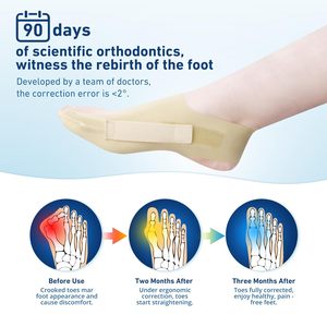 Bunion Corrector &amp; Adjustable <strong>Toe</strong> Spacer for Women &amp; Men-Big <strong>Toe</strong> <strong>Support</strong> with Side &amp; Heel Straps, Hallux Valgus Pain Relief - Product Image 2