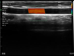 Mini scanneur à ultrasons sans fil, Portable, Type de sonde linéaire, Super largeur - Product Image 4