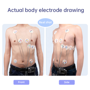 Moniteur ECG portable, appareil d'électrocardiogramme, analyse, systèmes d'ECG dynamiques, enregistreur, ECG Holter 12 canaux - Product Image 4