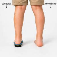 Semelles orthopédiques pour enfants : Soulagement de la douleur au talon, fatigue des jambes, soutien de la voûte plantaire, correction, respirantes, antidérapantes, en PU, inserts de chaussures – Direct Usine
