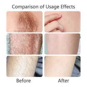 Crema Depilatoria OEM ODM para Piel Sensible, Crema Depilatoria Suave para Axilas, Brazos y Piernas, Cuidado de la Piel, No Irritante - Product Image 5