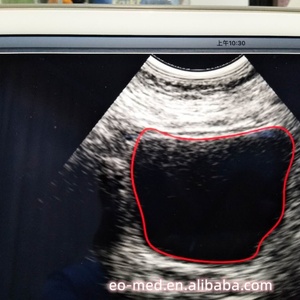 High Speed on Scan and Process (2s) Handheld Mini 4d Wireless Ultrasound Bladder Scanner B10 - Product Image 5