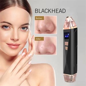 Removedor Eléctrico de Puntos Negros, Limpiador de Poros al Vacío, Extractor de Comedones, Removedor de Espinillas, Dispositivo de Belleza - Product Image 6