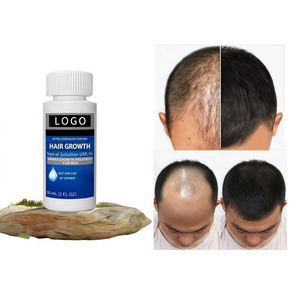Nouvel Arrivage Sérum Anti-Chute et <span class=keywords><strong>Repousse</strong></span> des Cheveux 5% Huile Naturelle Croissance Rapide Traitement Capillaire Formule 2-EN-1 Usage Domestique 60ml - Product Image 1