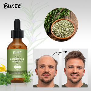 Huile Essentielle de Romarin Bio en Gros pour Soins Capillaires Naturels, Traitement Fortifiant du Cuir Chevelu, Huile Essentielle Stimulante pour la Croissance des Cheveux, Nourrissante à la Menthe Miele - Product Image 2