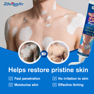 ZouRunAn krim penghilang Vitiligo, perawatan pigmentasi untuk kerusakan matahari, mengurangi noda & pengencangan warna kulit, perbaikan mendalam - Product Image 3