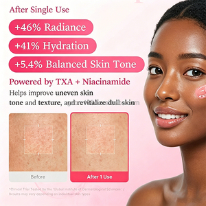 Creme em Cápsulas TXA Niacinamida 55g: Removedor de Pigmentação e Manchas Escuras, Hidratante Facial para <span class=keywords><strong>Melasma</strong></span> - Product Image 6