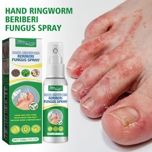 Spray de soins des <span class=keywords><strong>pieds</strong></span> Offres Spéciales apaisant démangeaisons <span class=keywords><strong>antifongique</strong></span> améliorer la sueur des <span class=keywords><strong>pieds</strong></span> malodorants - Product Image 5