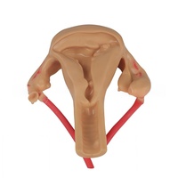 Modelo de Silicona 3D de Útero para Sutura y Disección Laparoscópica e Histeroscópica en Ginecología y Obstetricia