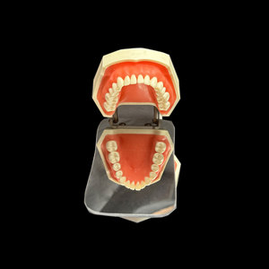 Réflecteur occlusal dentaire Heidefee, verre double face pour usage orthodontique, équipement de thérapie orale pour adultes - Product Image 1