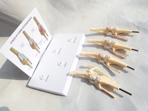 Modèle d'enseignement fonctionnel de luxe éducation en sciences médicales 4 étapes arthrite du genou anatomie chien kit de modèle d'articulation du genou - Product Image 4