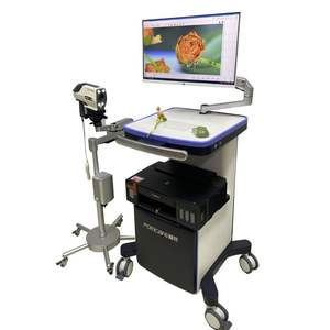 Colposcopio de Video HD, Cámara de Diagnóstico Vaginal para la Salud de la Mujer, Equipo Médico para Clínica y Hospital - Product Image 3