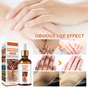 Suero de Vitamina C Natural Personalizado para Manchas Oscuras en los Nudillos, Hidratante Rápido, Blanqueador con Nicotinamida, Iluminador para Cuerpo, Articulaciones y Rostro - Product Image 3