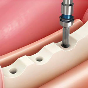 Vai a sorridere trapano per trapano per trapano per impianto dentale - Product Image 6