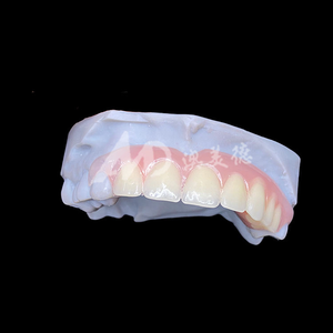 Service d'externalisation de prothèses dentaires flexibles personnalisées, prothèses amovibles Valplast pour laboratoire <span class=keywords><strong>dentaire</strong></span>, acceptation des fichiers STL - Product Image 5