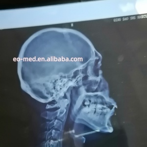 Impresora Digital de Películas de Rayos X para Hospital, de Alta Calidad y al Precio Más Bajo, Impresora de Inyección de Tinta para Películas de Rayos X con Certificación CE XP02 - Product Image 6