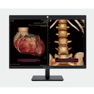 Nuevo Monitor Médico DICOM de 30 Pulgadas y 6 Megapíxeles con Pantalla Vertical en Escala de Grises para Lectura de Tomografía Computarizada, Radiología y Diagnóstico Veterinario - Product Image 5