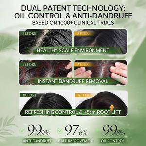 Shampooing <span class=keywords><strong>Solide</strong></span> à l'Huile d'Arbre à Thé Vert Sans Silicone pour <span class=keywords><strong>Cheveux</strong></span> Gras, Volumisant, Anti-Pelliculaire, Soin du Cuir Chevelu - Product Image 6