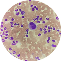 Fixed set Blood Test for medical microscope slide blood smear prepared microscope slides