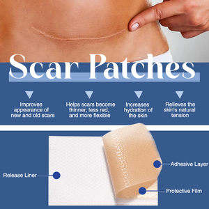 Feuilles de <span class=keywords><strong>silicone</strong></span> avancées pour cicatrices, feuilles professionnelles pour l'élimination des cicatrices, améliore l'apparence des cicatrices anciennes et récentes dues aux blessures, aux brûlures et aux interventions chirurgicales - Product Image 3