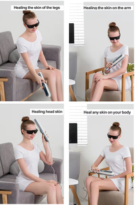 Çekirdek KN-4003B <span class=keywords><strong>UVB</strong></span> lamba tüpü UV fototerapi tedavisi sedef <span class=keywords><strong>Vitiligo</strong></span> dar bant <span class=keywords><strong>Narrow</strong></span> nm ampul - Product Image 6