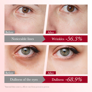 SADOER Crème Contour des Yeux Raffermissante et Hydratante au Collagène de Cerise, Soin Hydratant Anti-Cernes et Sérum Élastifiant pour les Yeux - Product Image 5