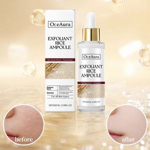 Agente de Compras 1688: Exfoliante Facial Suave de Arroz Blanco OEM/ODM para Eliminar Células Muertas de la Piel - Product Image 4