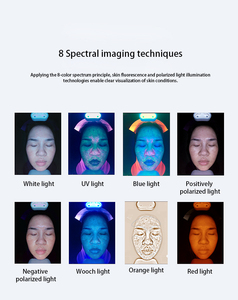 เครื่องวิเคราะห์ผิวหนังรุ่นฮิตปี 2026 ราคาประหยัด พร้อม AI อัจฉริยะ ตรวจวัดความชุ่มชื้นและวิเคราะห์สภาพผิว - Product Image 5