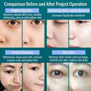 Máquina Facial Profesional de Limpieza Profunda de la Piel 8 en 1 / 10 en 1, con Microdermoabrasión de Oxígeno - Product Image 5