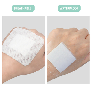 Medizinische Wundversorgung Sterile Selbstklebende Atmungsaktive Wundauflagen Absorbierende Pads Pflaster CE-Zertifiziert Klasse I Größen - Product Image 2