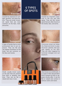 Iperpigmentazione causata da metalli pesanti nei cosmetici 4 In1 macchia della pelle Melasma per la pigmentazione del viso Peel rimuovere il Set di trattamento - Product Image 5