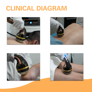 Perangkat Terapi Gelombang Kejut Magicbelle untuk Meredakan Nyeri Tubuh dan Cocok untuk Hewan Peliharaan yang Mengalami Cedera Olahraga, Arthritis, dan Penggunaan di Rumah - Product Image 2