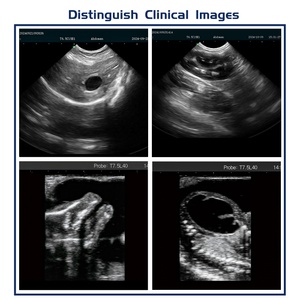 Pemindai Ultrasound medis hitam dan putih portabel untuk instrumen kedokteran hewan manusia dan kuda dalam Diagnosis - Product Image 3