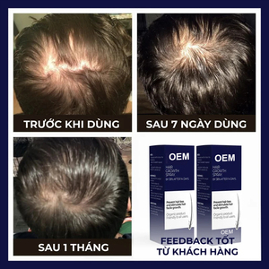 Spray para <span class=keywords><strong>el</strong></span> crecimiento del <span class=keywords><strong>cabello</strong></span>, ingrediente herbal, espray esencial, suero anticaída de <span class=keywords><strong>cabello</strong></span>, líquido de tratamiento de crecimiento rápido efectivo de 7 días - Product Image 2