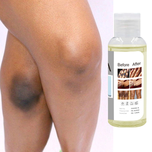 El Mejor Aceite Exfoliante Amarillo Natural, <span class=keywords><strong>Extra</strong></span> Fuerte, Orgánico, Vegano, Crema Exfoliante Hidratante - Product Image 1