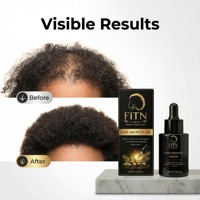 Serum Minyak Penumbuh Rambut 60ml 2 Pack Perawatan Minyak Jarak untuk Rambut Afro Alami Organik Grosir OEM ODM Label Pribadi FITN