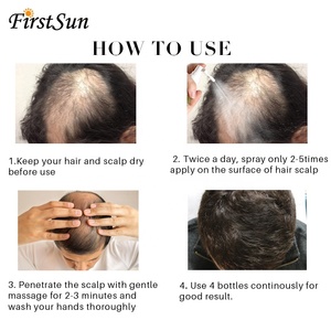 Laca para el cabello para el tratamiento de la pérdida de cabello aceite esencial para el crecimiento rápido del cabello - Product Image 4