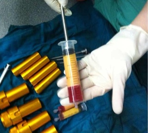 Klinische 4000 Rpm Spuit Zelfvet Transplantatie Stamcel Cosmetische Medische <span class=keywords><strong>Centrifuge</strong></span> - Product Image 4