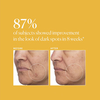 Serum Wajah Pemutih Anti-Penuaan TXA+Niacinamide 15% Perawatan Pasca Bercak Noda All-in-One Harian Asam Traneksamat 5% Potensi Tinggi