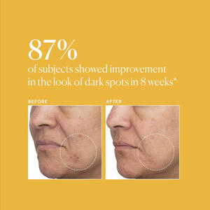 Suero Facial TXA+Niacinamida 15% Blanqueador Antiedad con Efecto Luminoso, Cuidado Post-Manchas, Todo en Uno, Ácido Tranexámico de Alta Potencia 5% - Product Image 6