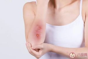 KN-8000A1 Kernel alat medis cahaya merah daya tinggi terapi penyembuhan luka - Product Image 4