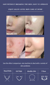 Dispositivo Portátil de Cuidado Facial Profundo sin Agujas Hello Face2 2026, Pistola de <span class=keywords><strong>Mesoterapia</strong></span>, Inyector, Peeling Acuático, Cuidado Facial - Product Image 3