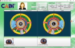Analyseur de Scanner d'Iris USB, Caméra d'Iridologie Iriscope 12MP, Analyse d'Iris, Logiciel <span class=keywords><strong>Iridoscope</strong></span> Pro, Caméra d'Iridologie Portative - Product Image 6